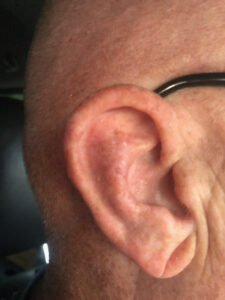 image of ear